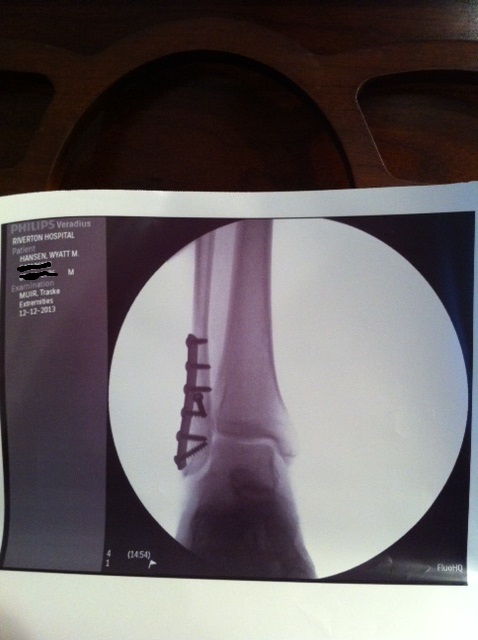 Name:  New leg plate.JPG
Views: 594
Size:  65.8 KB